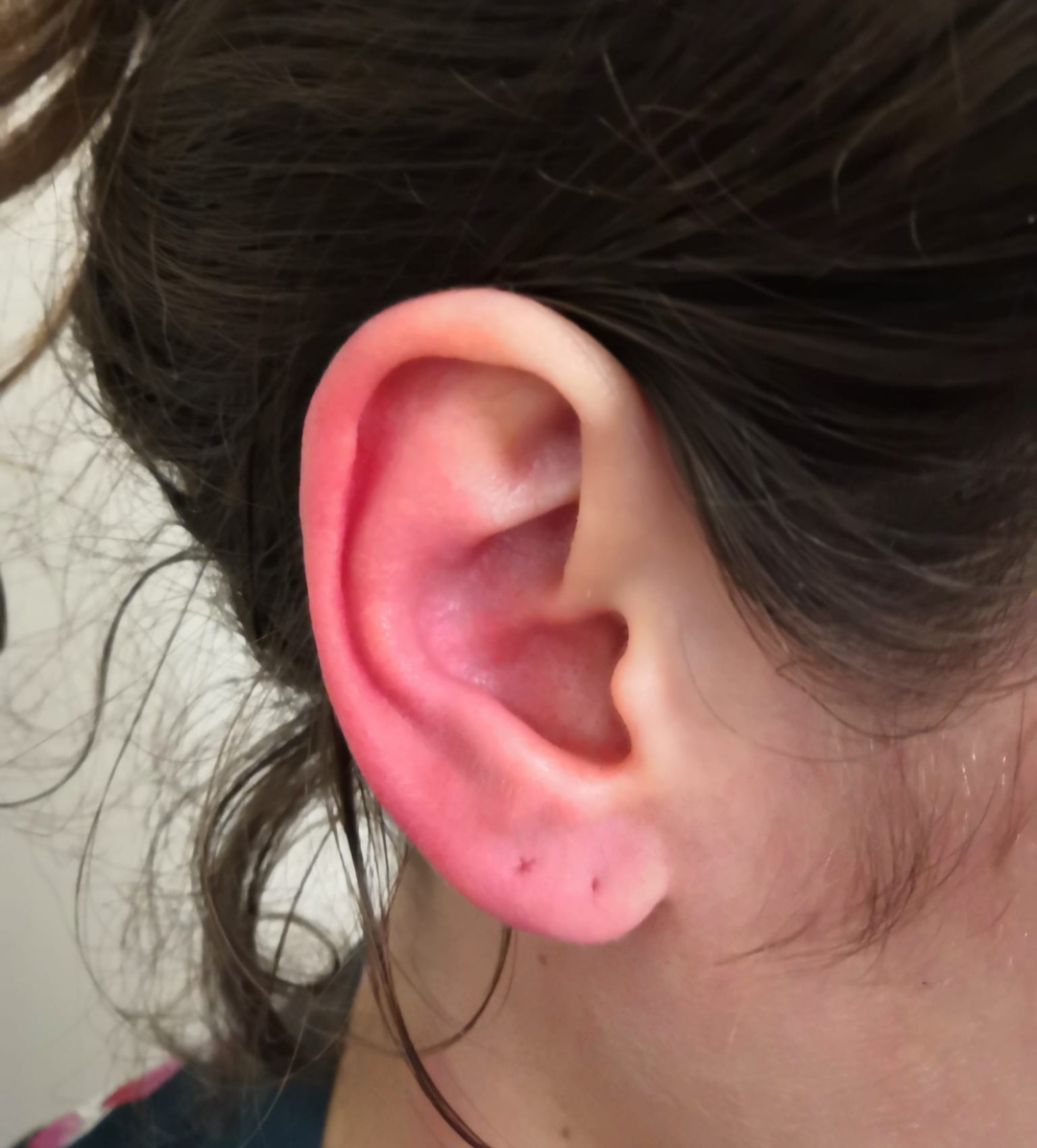 Right ear
